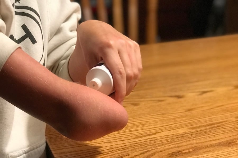 Daily Care of Your Residual Limb